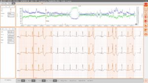 Cardioline Cubeholter Software-image