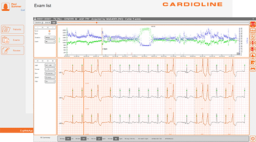 Cardioline ecg webapp holter screenshot exam list. Voor analyse gemaakte holter ecg